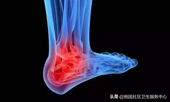 哪些运动有利于脚的恢复,保护脚的运动有哪些