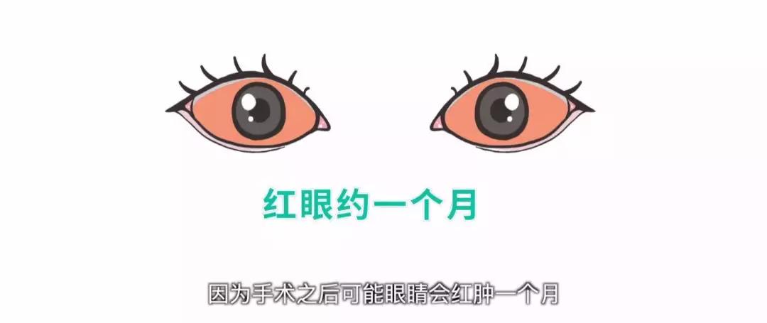 斜视该怎么办,眼睛斜视好治吗多长时间能治好