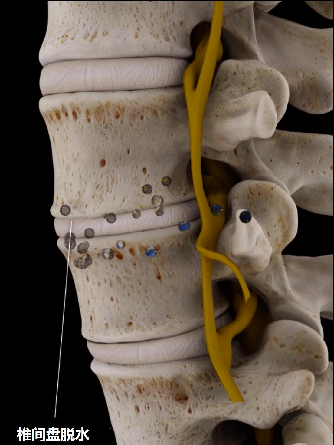 介绍一下治腰痛小窍门,不同腰痛的诊断与治疗