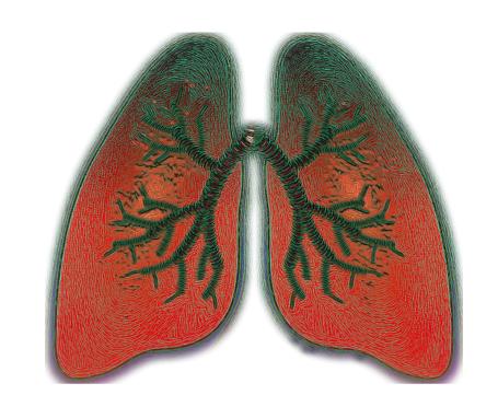 无创呼吸机：还给慢阻肺患者自由空气