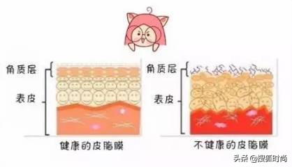 戴口罩起痘、皮肤压伤？关于非常时期的10个皮肤问题一次性解决