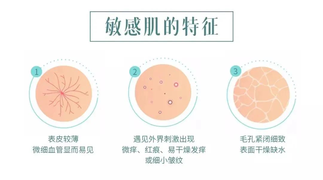 脸过敏干燥起皮紧绷发红怎么修复,换季皮肤过敏起皮用什么药