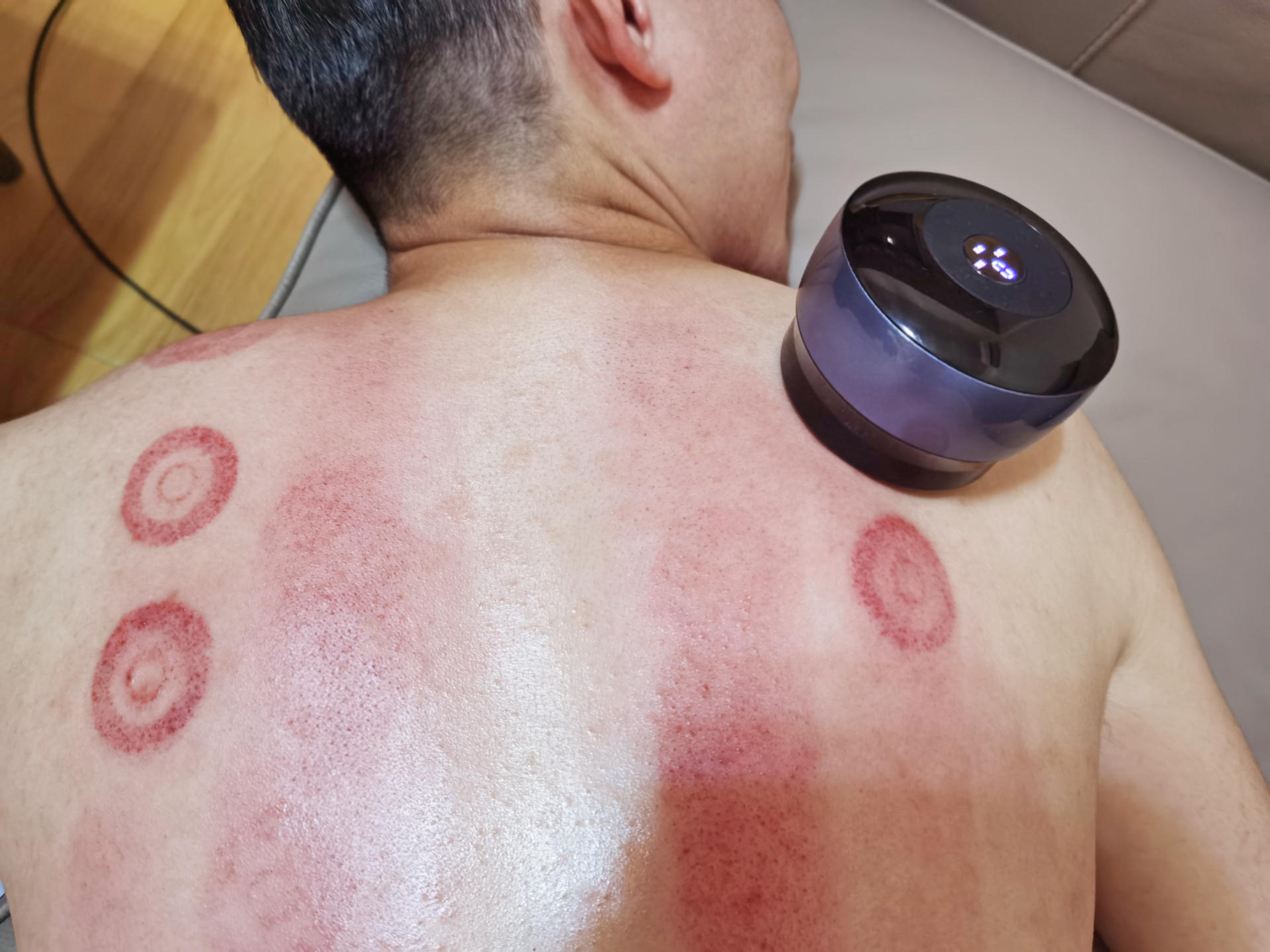 养生馆用刮痧走罐按摩器,走罐刮痧按摩器测评