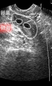 什么时候测排卵时间最佳,什么时候测排卵最好