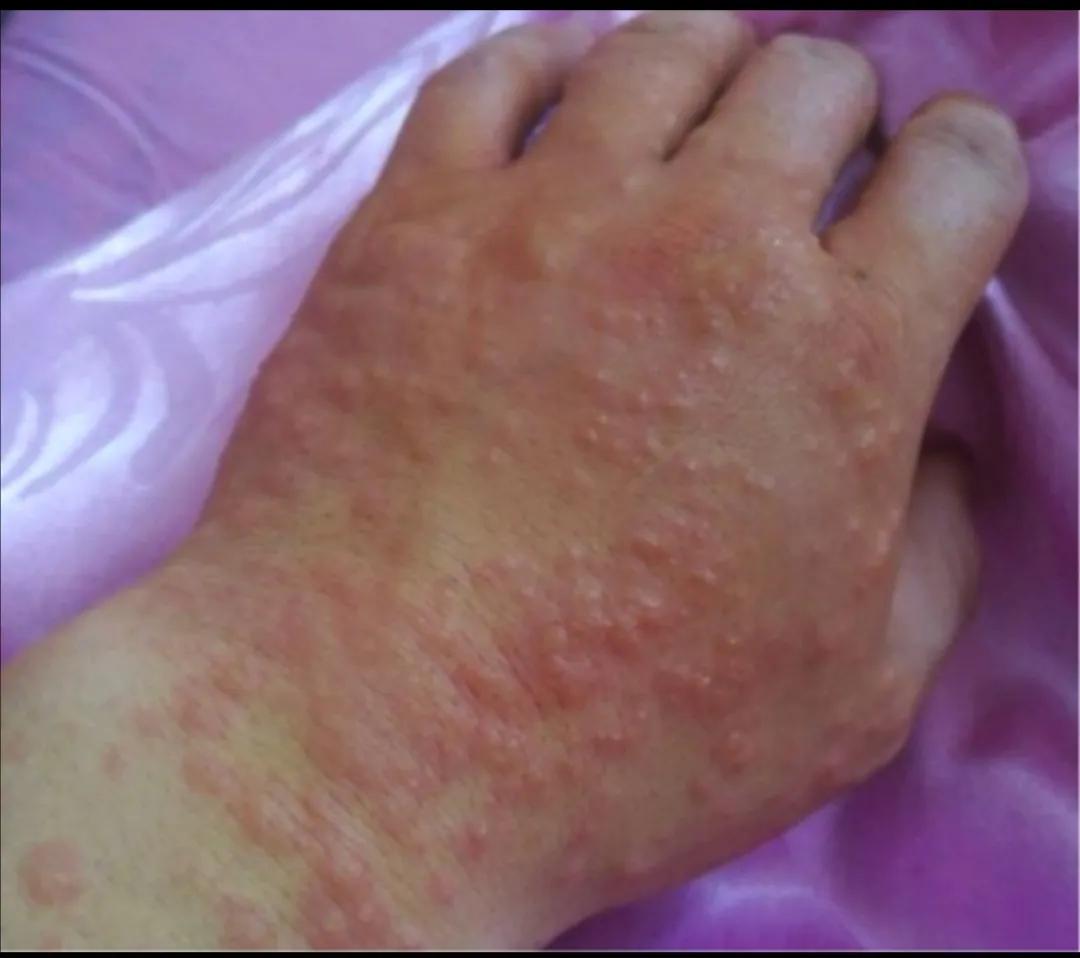 阴寒体质的人有哪些表现,现在的人为什么戾气很重