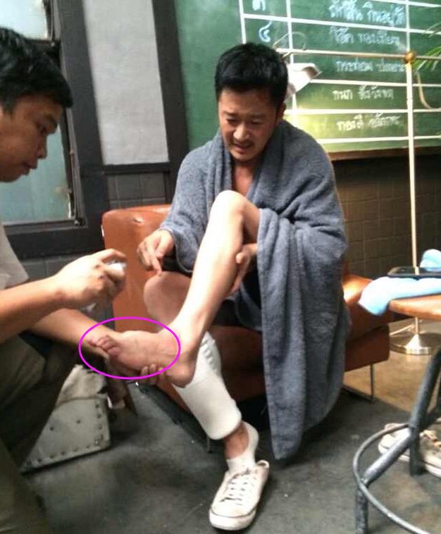 吴京全身缝针,吴京全身缝针高达100多针