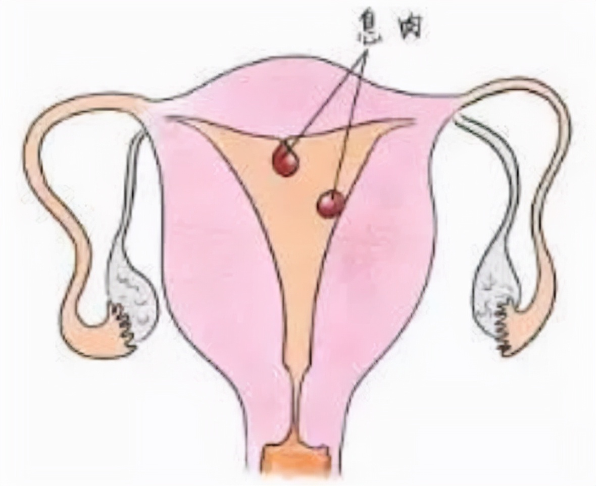 不孕不育月经不调多囊,不孕不育月经不调