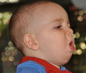 儿童支气管炎的原因,儿童患支气管炎的原因