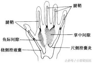 手机*党**、键盘侠们，你的手指妹儿还好吗？818你不知道的腱鞘炎！