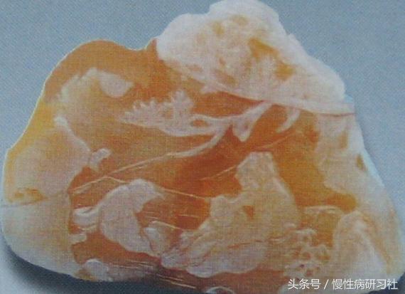 台媒揭肝胆排毒*局骗**：不过是白花钱的魔术表演（图）