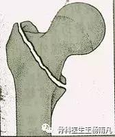 鬼门关前一道坎全集,鬼门关前的一道坎