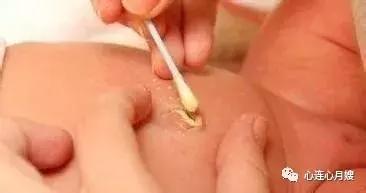 新生儿最重要的护理环节是什么,新生儿照顾的重点是什么