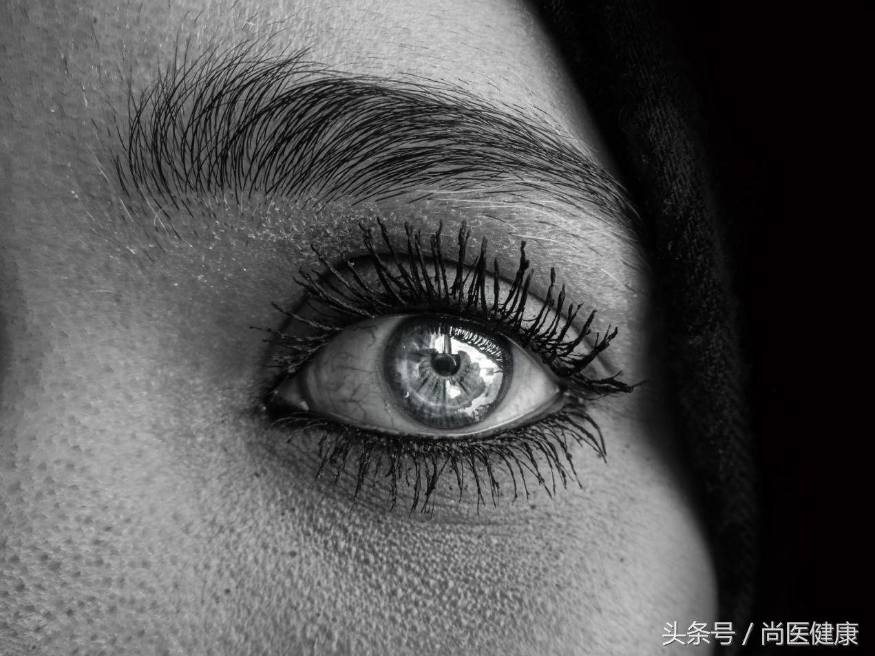 眼睛周围有脂肪粒可以冷冻去除吗,眼睛周围的脂肪粒怎么去除图片