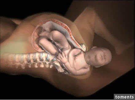 震撼分娩瞬间,分娩过程震撼