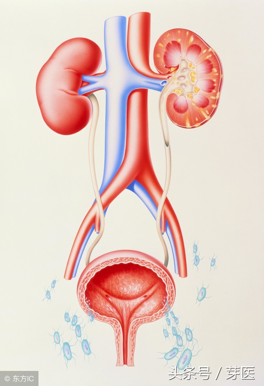 别拿豆包不当干粮，女生们，别把尿路感染不当回事儿