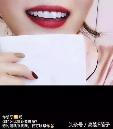 高圆圆牙齿美白,高圆圆40岁美白秘诀