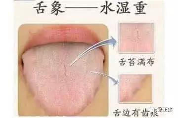 抗生素过量引起的妇科病怎么办,妇科病为什么反反复复治不好