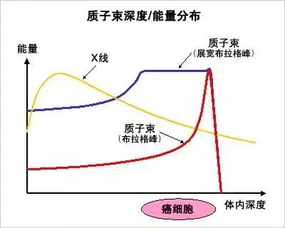 质子治疗击败传统放疗成儿童脑瘤治疗新希望
