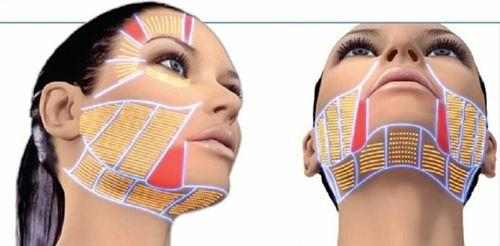 2022最火的除皱方式,目前除皱最安全有效的方法