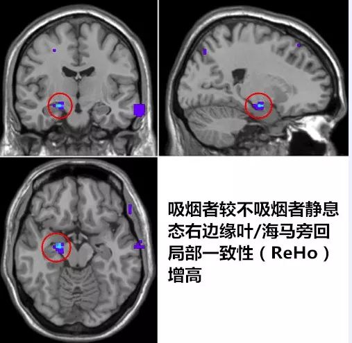 吸烟为什么会上瘾怎么戒,吸烟的禁忌及危害如何科学戒烟