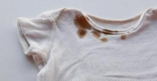 衣服上有牙膏怎么快速清理,生活小妙招清洁衣服上的黄渍