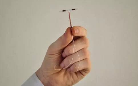 上环容易下环难，是时候揭露女性“取环”真面目了