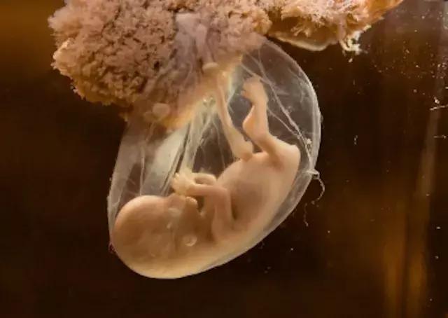 不想让胎宝宝提前发动,胎宝胎动频繁不舒服原因