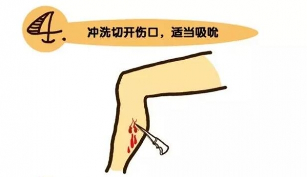 遇到毒蛇怎么办？专业知识还是需要的！