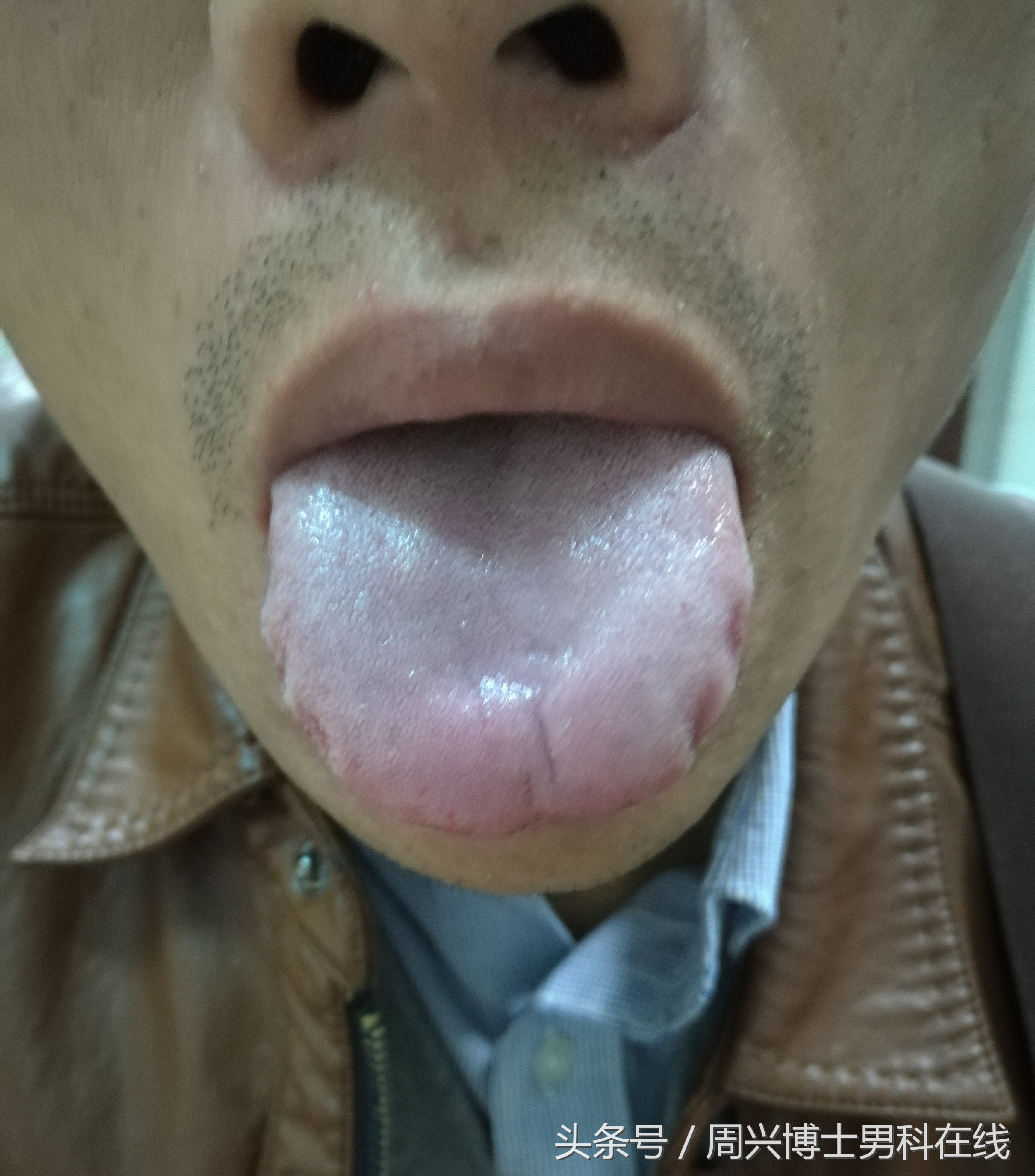 辨清“肾虚”,让大家明明白白“补肾”