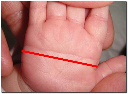 会得大病的手相掌纹,不懂中医怎么看手相