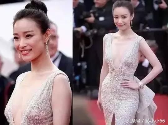 你好，你胸部外扩吗？