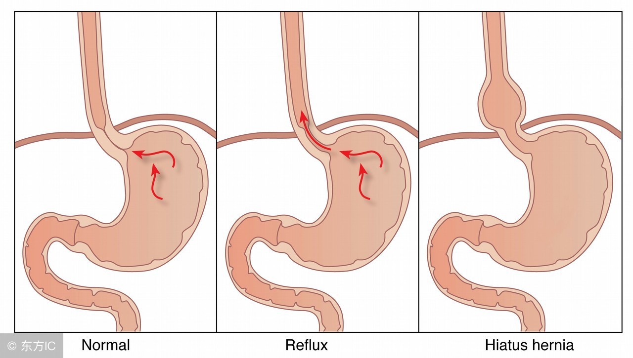 宝宝咳嗽家长最怕什么,孩子一咳嗽家长就害怕
