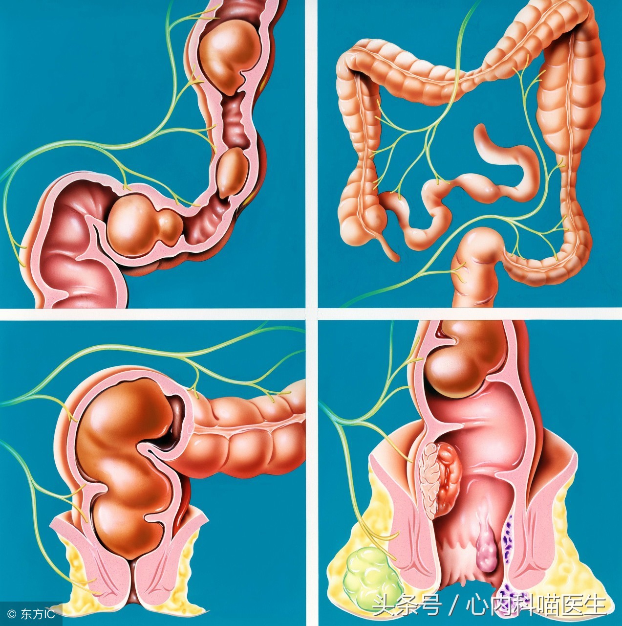 便秘多久排便一次算正常,什么是便秘拉得多