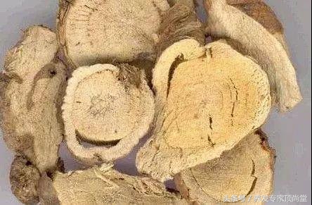 顽固性头屑头痒怎么治,头痒头屑头油多怎么办