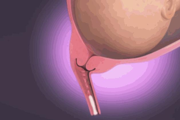 十月怀胎要闯这九关，看看孕期的你现在闯到第几关了?