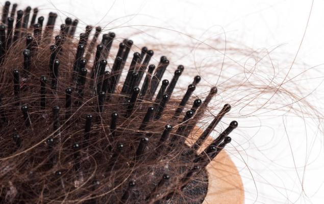 春季头上痒有头皮屑怎么办,头痒长头皮屑用什么方法治疗