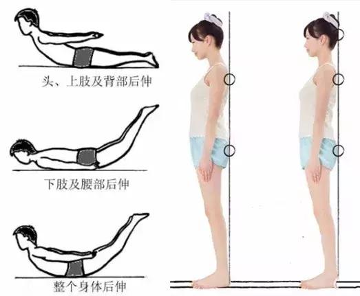 枕啤酒瓶能治颈椎骨刺吗,颈椎病枕啤酒瓶子好不好