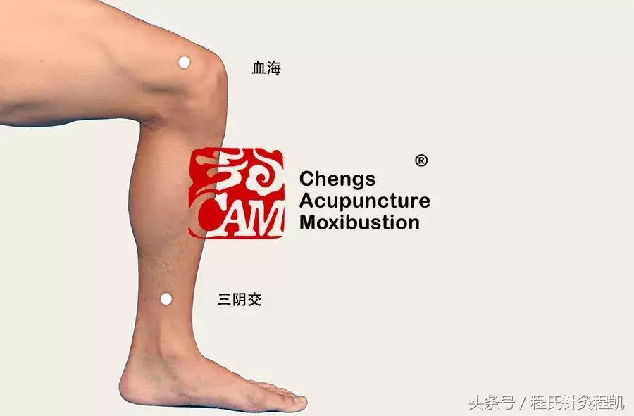 程凯养生说血瘀按什么穴位,程凯养生说血瘀治疗方法