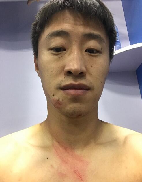足球被爆头,足球守门员被爆头