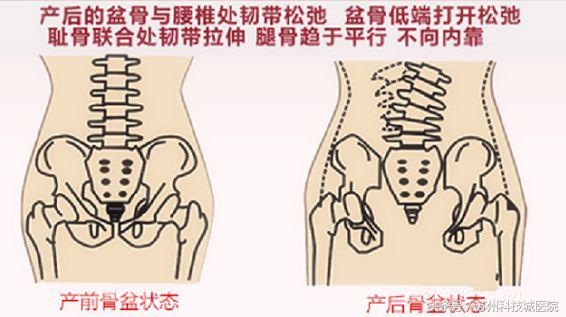 二胎盆底肌比较难恢复吗,二胎盆底修复有效果吗