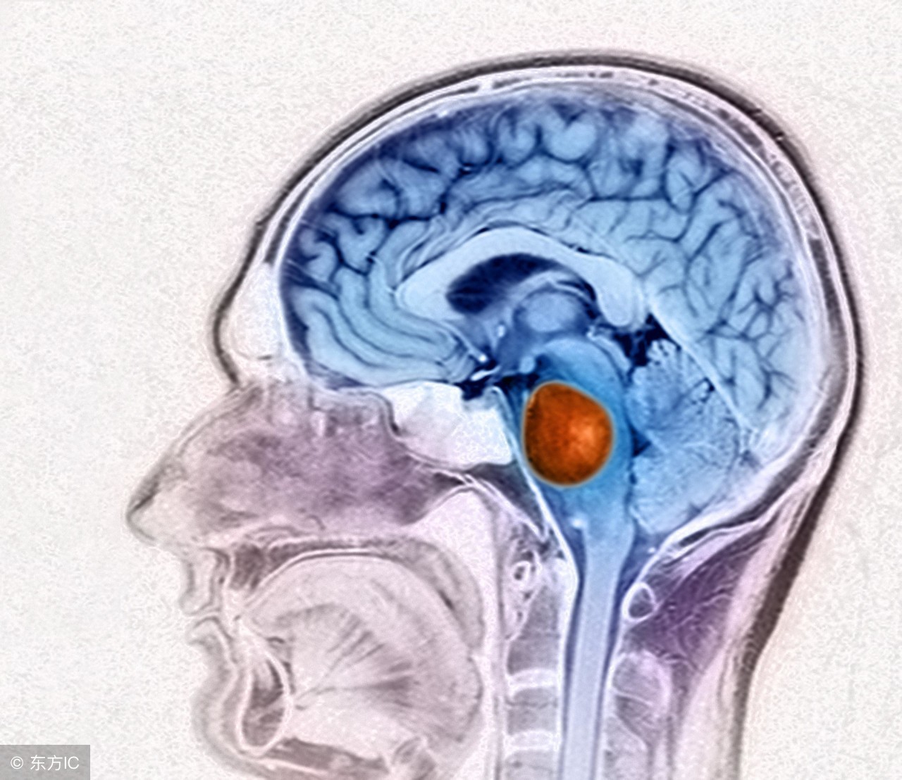 身边好医生许典双：“拆弹工匠”让脑瘤患者也有高质量生活