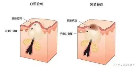 蔡徐坤angelababy2018,蔡徐坤用什么护肤