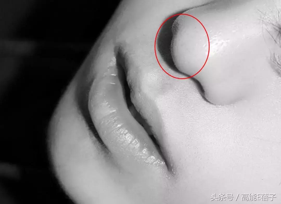 蔡徐坤、Angelababy都根治不掉的黑头，微商神器能去除？