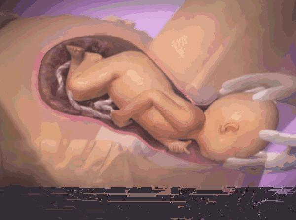 孕12周胎盘低置有宫腔积液怎么办,12周孕妇b超显示胎盘低置有危险吗