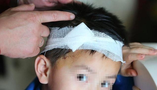 风筝线隐形杀手视频,风筝线暗藏杀伤力