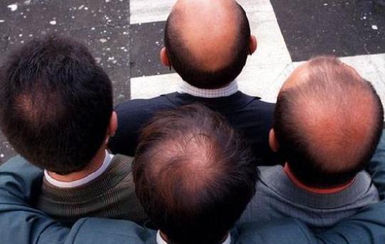 看看你属于哪种额头,有什么样的额头