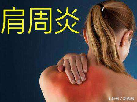 肩膀疼是肩周炎,很多肩膀痛的原因根本不是肩周炎