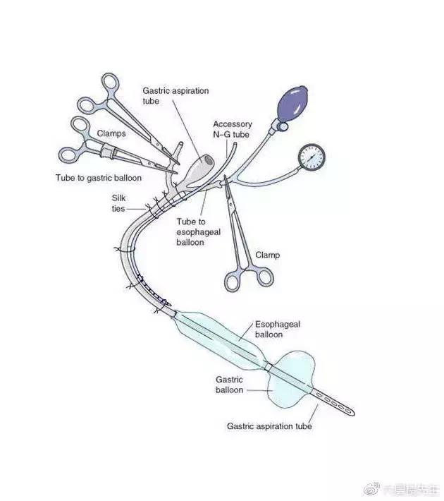 灯泡塞进肛门，医生微博求助手术方案……