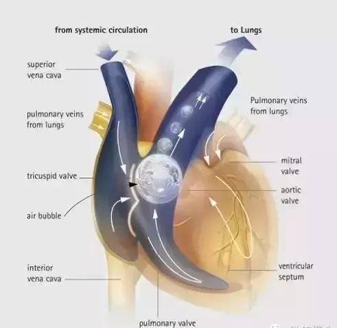 双氧水能治疗伤害,长期使用双氧水会导致什么