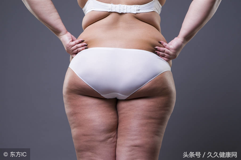 绑腹带能不能用？产后瘦身怎么做最好？